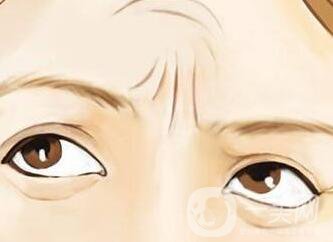 伊維蘭注射除皺多少錢？伊維蘭注射除皺價(jià)格分析