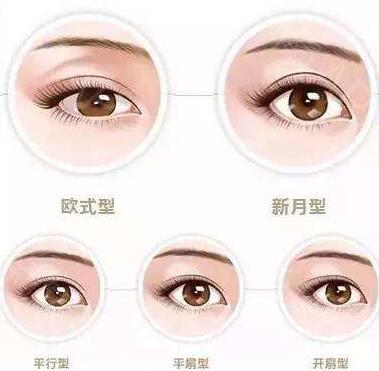 北京雙眼皮價格是多少