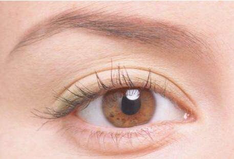 深圳埋線雙眼皮多少錢