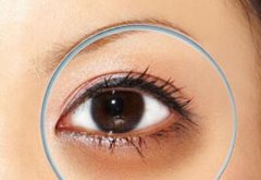 北京玻尿酸去黑眼圈價(jià)格