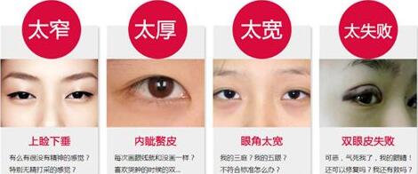 廣東眼部整形失敗修復(fù)手術(shù)費用