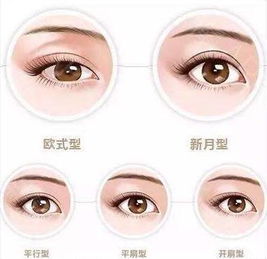 廣東下眼下至手術(shù)費(fèi)用