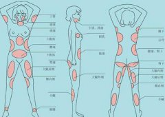 南京吸脂減肥價格是多少？