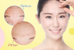 抬頭紋怎么調(diào)節(jié)？調(diào)節(jié)抬頭紋方法有哪些？