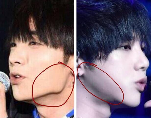 華晨宇整容前后照片 華晨宇做了下頜角整形？