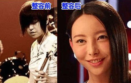 于文文整容了嗎？于文文整容前后圖