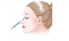 注射隆鼻的材料有哪些？那種好？多少錢？