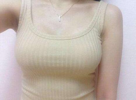 北京做假體豐胸價(jià)格是多少錢呢