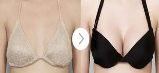 假體豐胸危害有哪些？假體豐胸有副作用嗎？