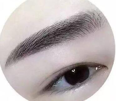 種植眉毛調(diào)節(jié)眉毛缺損手術(shù)是什么？