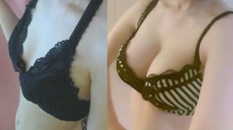 妙桃假體豐胸費(fèi)用？妙桃假體大概多少錢(qián)？