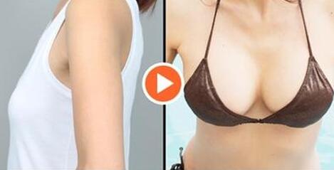 上海假體豐胸費用、上海假體豐胸手術(shù)多少錢？