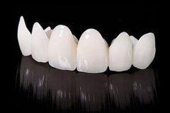 種植烤瓷牙的危害？種植烤瓷牙應(yīng)該如何選擇？