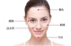 中面部提升術(shù)會(huì)維持幾年？中面部提升術(shù)會(huì)維持多久？