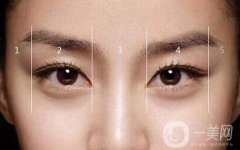 割雙眼皮大概多少錢？價格是多少？