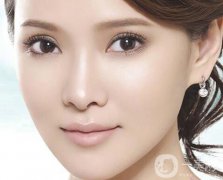 割雙眼皮要恢復多久 注意事項有哪些