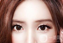 割雙眼皮價格是多少錢？收費明細(xì)~
