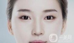 開眼角多久恢復(fù) 術(shù)后要如何護(hù)理