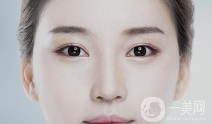 開眼角多久恢復 術后要如何護理