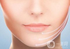 下頜角磨削多少錢 下頜角磨削收費明細(xì)