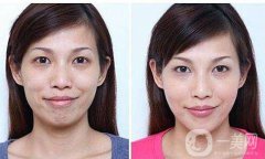 熱瑪吉果好嗎？熱瑪吉除皺果怎么樣？