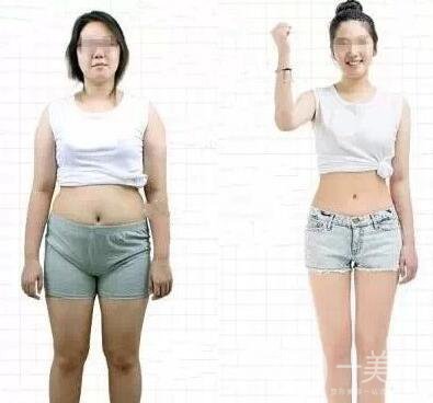 水動力吸脂瘦身*果怎么樣