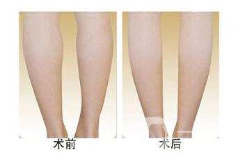 廣州*多少錢(qián)