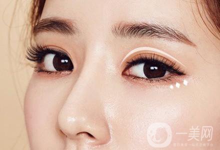 高分子雙眼皮是*嗎?高分子雙眼皮適合哪些人？