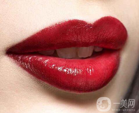 豐唇多少錢？豐唇價格明細盤點~