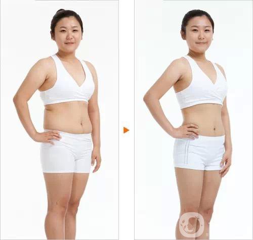 360吸脂減肥多久恢復(fù)正常?要注意些什么？