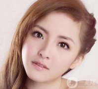 生物焊接雙眼皮價(jià)格一般是多少？