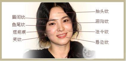 雙美膠原蛋白隆鼻怎么樣?*果能維持多久？