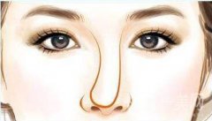 歪鼻矯正需要多少錢？歪鼻矯正價格