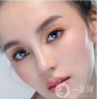 北京隆鼻價(jià)格 北京隆鼻貴不貴