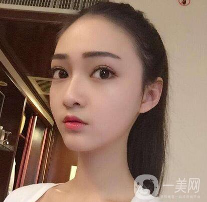 削骨手術(shù)價(jià)格 削骨手術(shù)一般多少錢