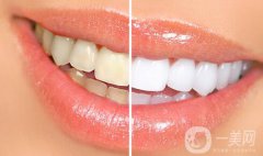 四環(huán)素牙怎么變白？四環(huán)素牙怎么辦？