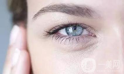 去魚尾紋的方法有哪些？玻尿酸去魚尾紋怎么樣？