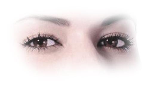 焊接雙眼皮是什么？手術后多久能好？