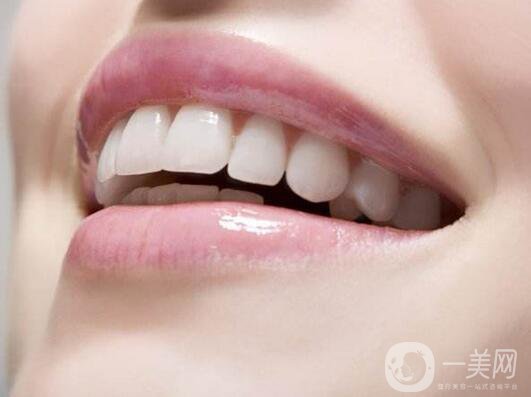 烤瓷牙價格和種類詳細介紹