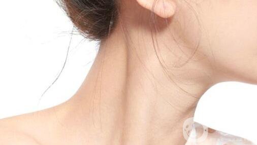 有頸紋怎么辦？去頸紋什么方法好？