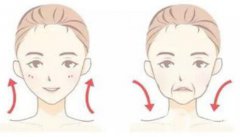 怎么除去法令紋？什么方法可以去法令紋？
