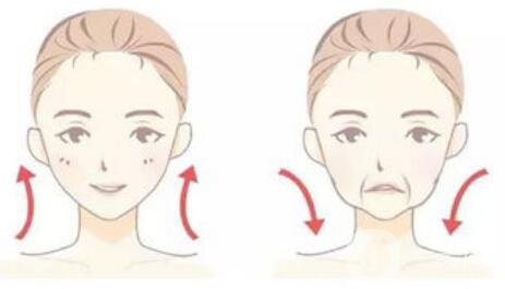 怎么除去法令紋？什么方法可以去法令紋？