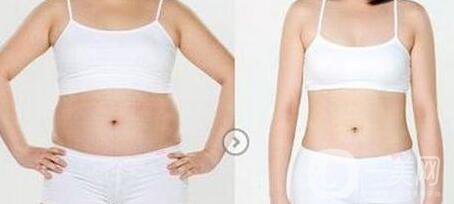 南京吸脂減肥的價格是多少？吸脂減肥大概多少錢？