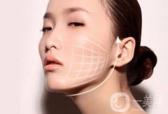 微創(chuàng)面部提升價格是多少?微創(chuàng)面部提升多少錢