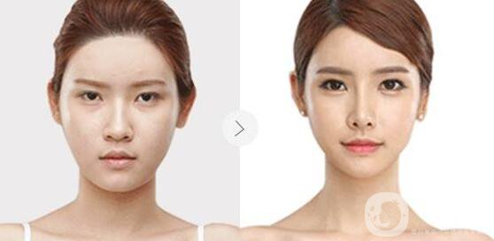 瑞蘭2號,多少錢