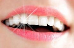 皓齒美白牙齒多少錢 皓齒美白牙齒價(jià)格
