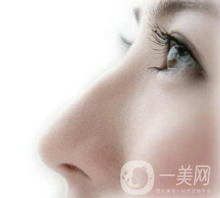 駝峰鼻矯正價錢一般是多少？