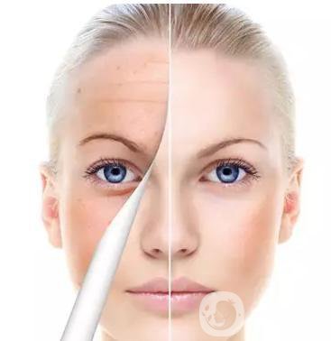 如何調(diào)節(jié)咖啡斑才*不反彈？