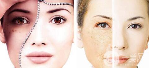 光子嫩膚價(jià)格多少、做光子嫩膚需要多少錢