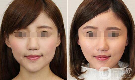 *大概要多少錢、*的費(fèi)用詳解